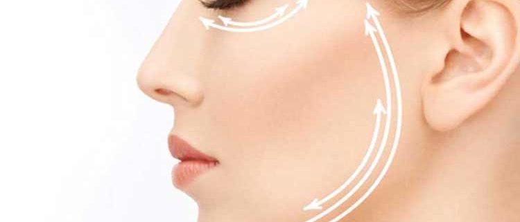 filler acido ialuronico